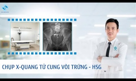 Chụp X-quang tử cung vòi trứng (HSG)